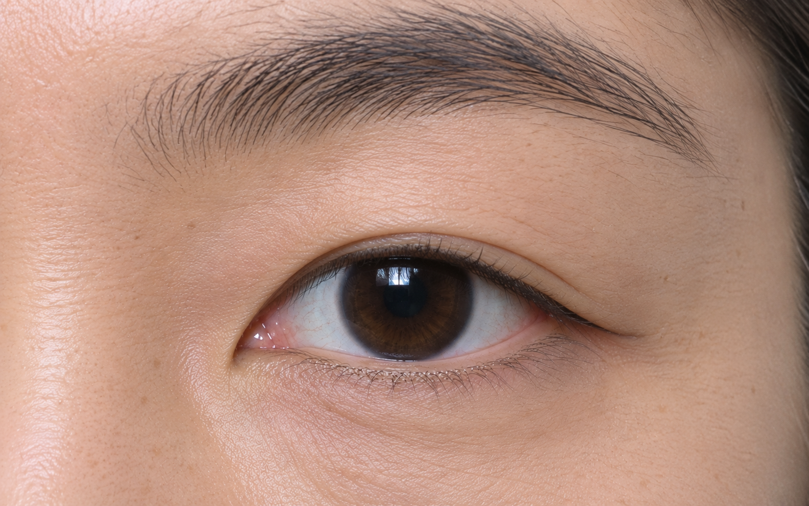 수술전 Before